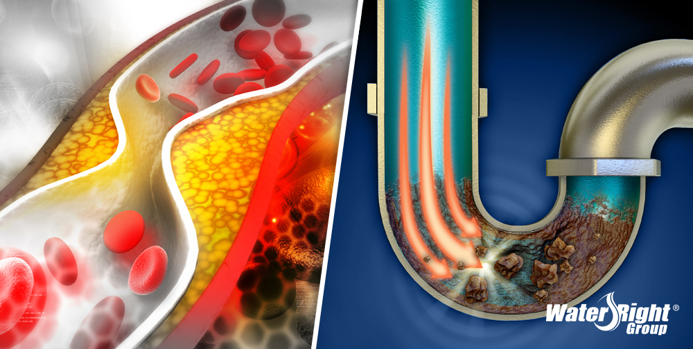 What Hard Water Plumbing Problems and High Cholesterol Have in Common