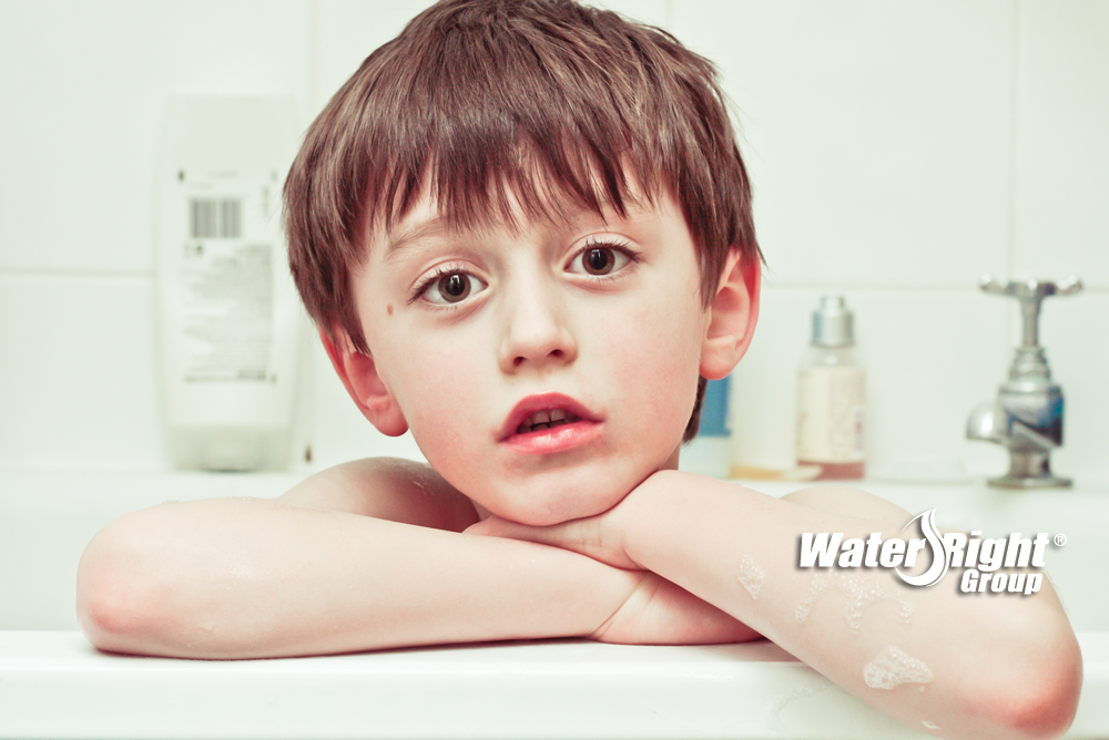 kid with eczema in hard water bath